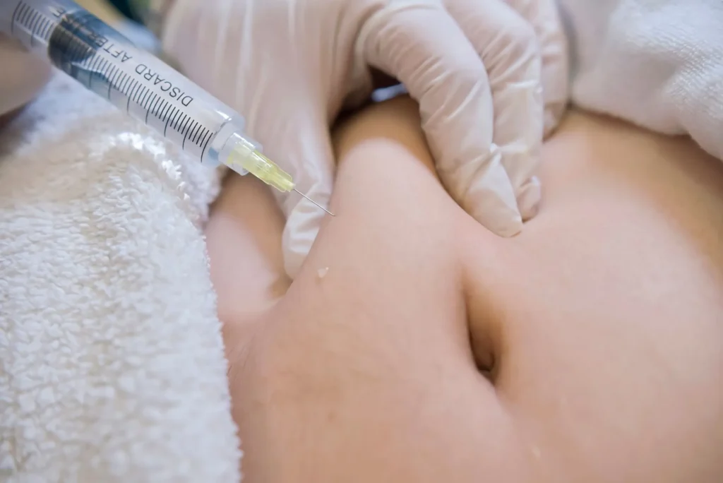 Fat-Dissolving Injections Sculpt Your Physique